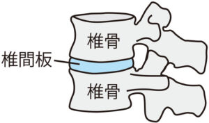 椎間板イラスト（横から）