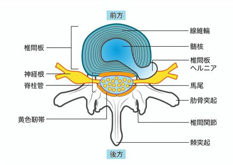 背骨の断面図イラスト