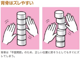 背骨はズレやすい構造